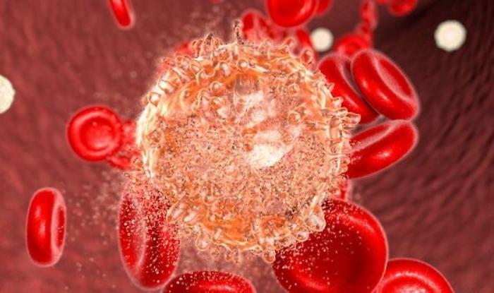 Leucemia linfobalstica acuta scomparsa nell'86%  dei pazienti con cellule Carcik