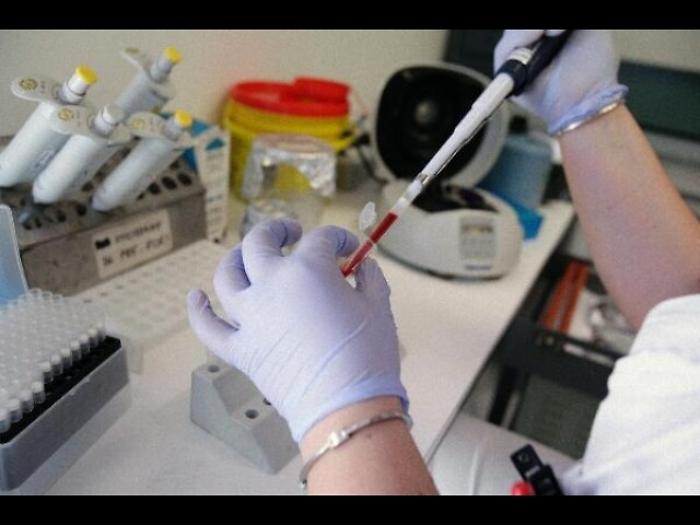 Meningite: 21enne muore nell'Aretino