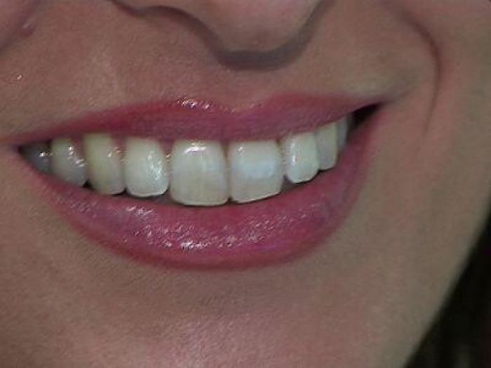 Salute: igiene orale, 8 regole per accogliere la primavera col sorriso