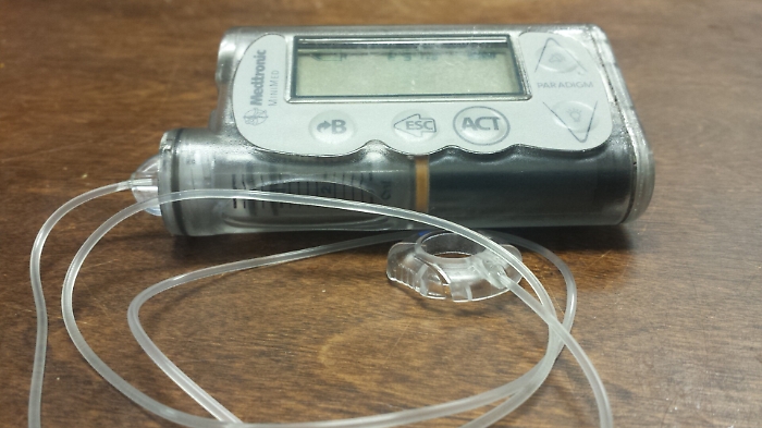 Diabete, in Italia prima 'micropump' insulina senza catetere