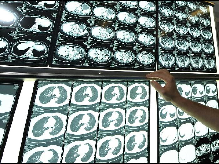 Dona rene a amica,gesto mi ha dato forza