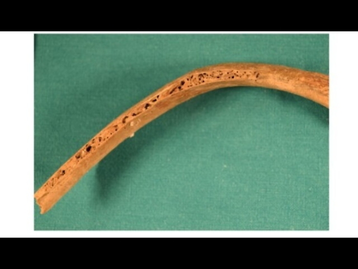 S.Nicola: online video prelievo reliquia