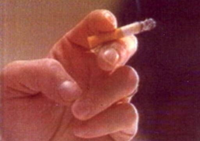 A Catania le diagnosi di tumore al polmone in due anni cresciute del 30%