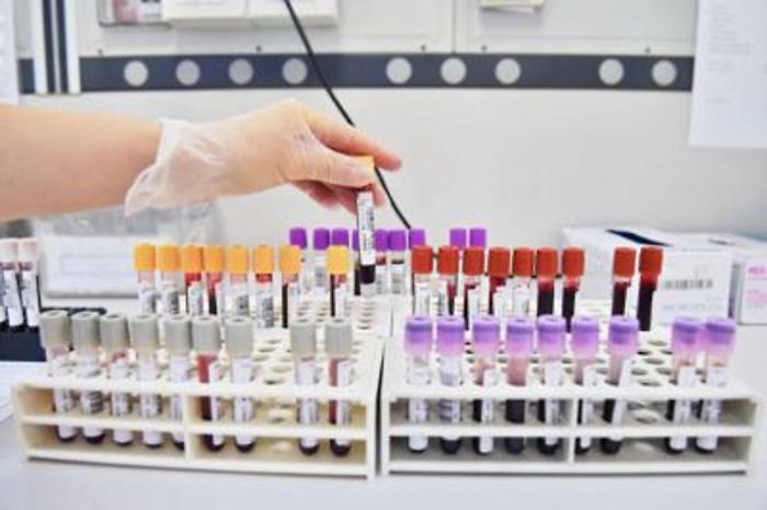 Meningite, sta meglio la 14enne ricoverata a Roma