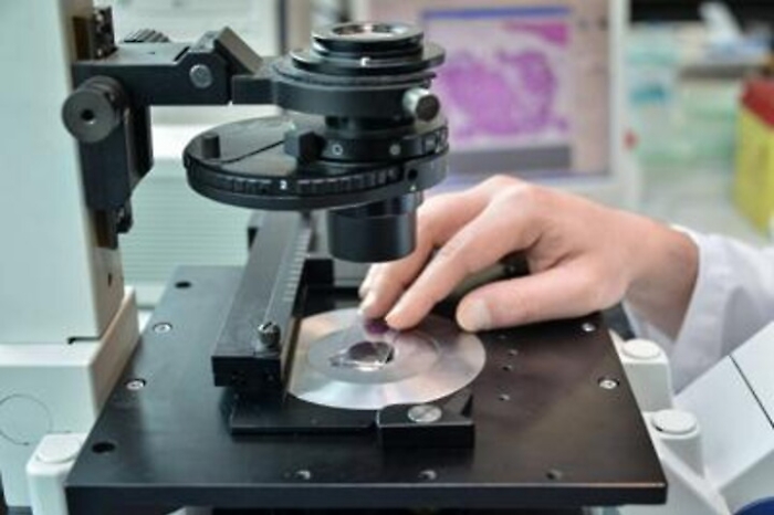 Tumori: la dermatologa, 'Italia pioniera nella microscopia confocale'