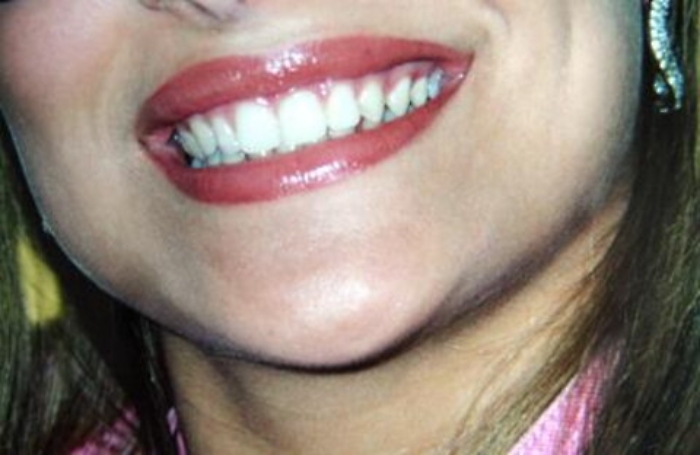 Ecco 'Face', il robot che capisce rabbia, sorpresa e felicit&agrave;