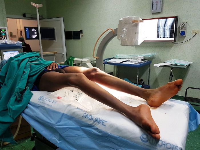 Cos&igrave; Mohamed dopo lo sbarco potr&agrave; ricominciare a camminare