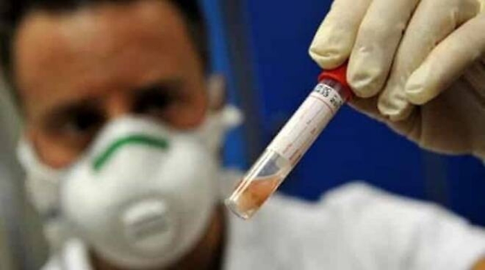 Caso di meningite ad Agrigento