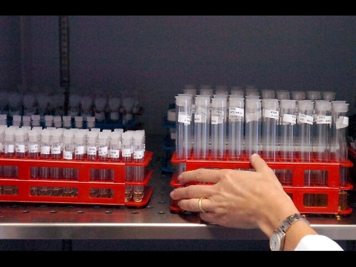 Lesioni nervi,materiale chiave da Italia