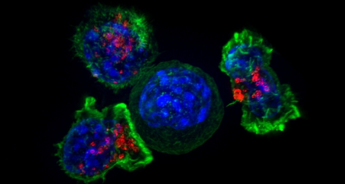 Arriva in Italia Car-T, il farmaco che ferma i tumori del sangue