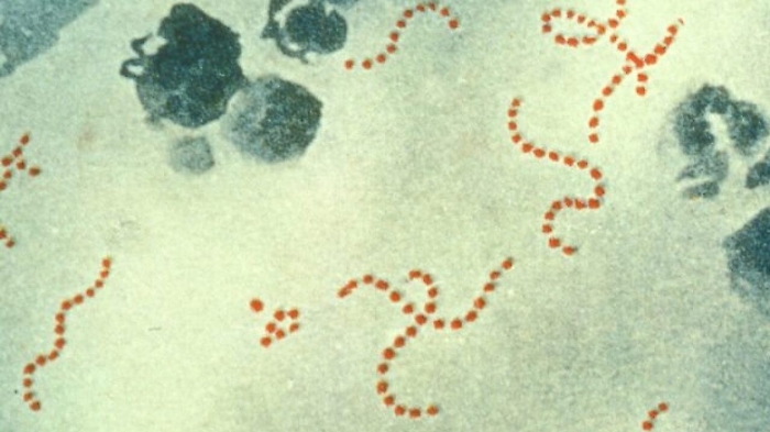 Epidemia di iGas in Inghilterra, 12 morti per colpa di un batterio killer