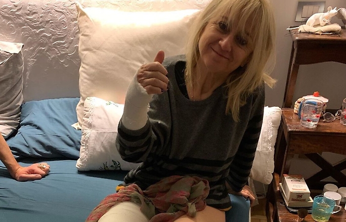 Luciana Littizzetto "vola" in strada e finisce con due ingessature