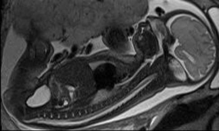 Medicina: al D'Amore Hospital risonanza magnetica su feto di 19 settimane