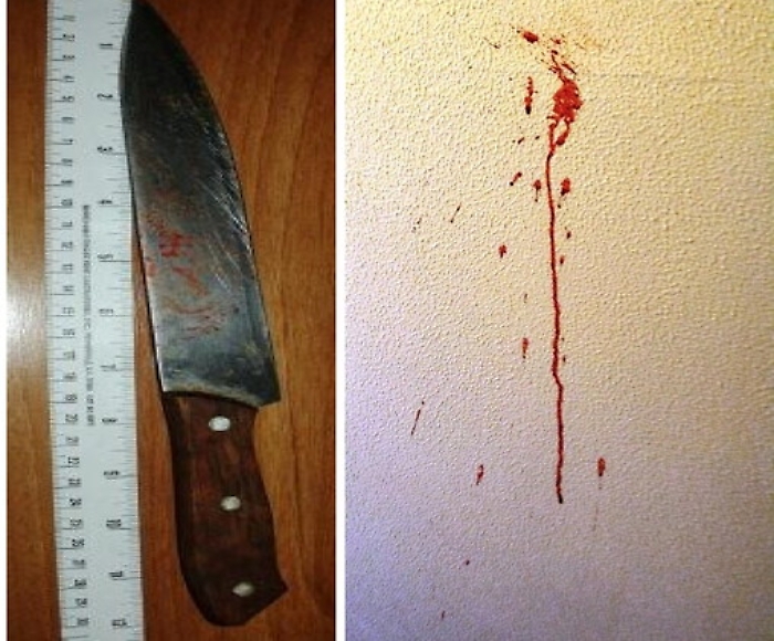 Acireale, non paga la sua parte di affitto e zio accoltella nipote