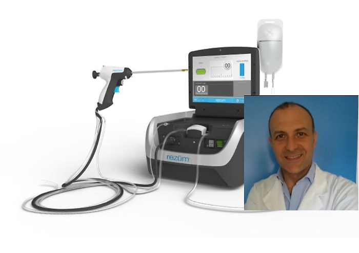 All'ospedale di Gela per ridurre la prostataniente bisturi e cicatrici: si usa il vapore