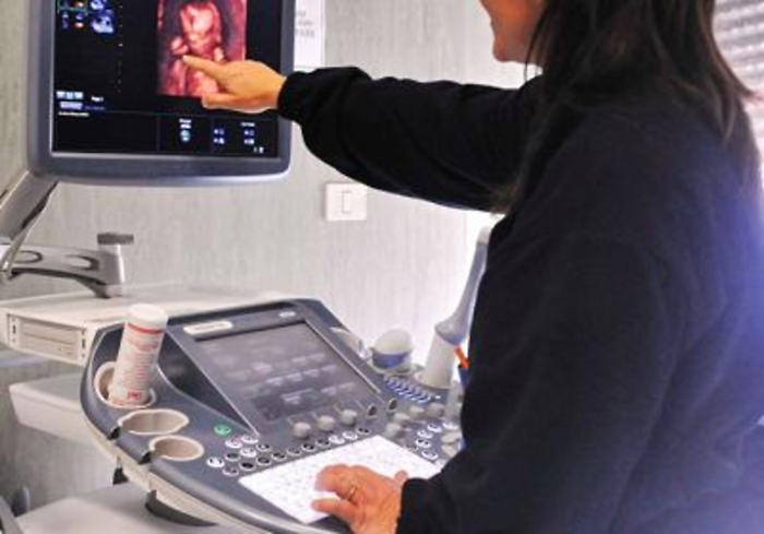 Ricerca: la tesi, cesarei influenzano evoluzione specie verso beb&egrave; pi&ugrave; grandi