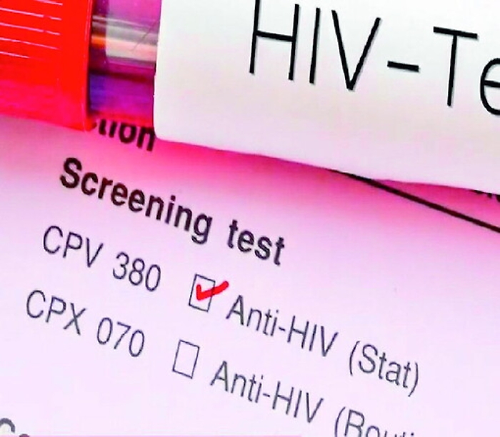 Aids e tubercoli, in Sicilia casi raddoppiati in sette anni