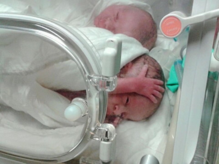 Parto trigemellare ad Agrigento, i beb&egrave; stanno tutti bene