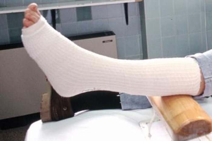 Salute: 'crack' osso per fragilit&agrave;, in Italia 230 mila fratture all&rsquo;anno