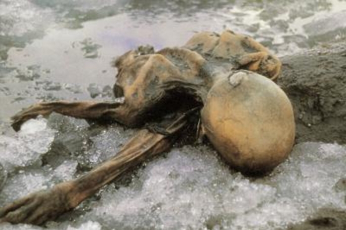 Medicina: &Ouml;tzi era malato di cuore, 3 calcificazioni nelle coronarie