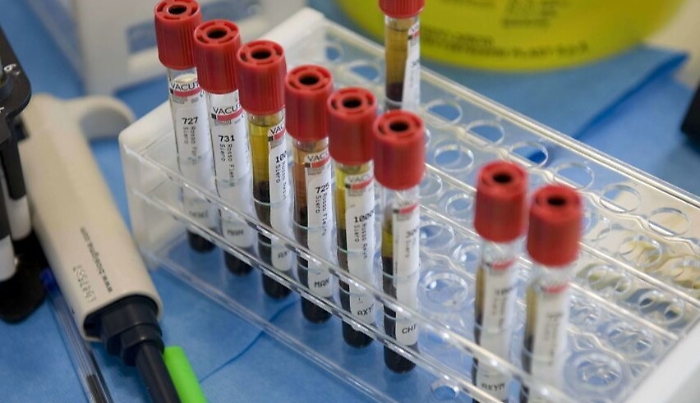 Estorsione, 79 mila euro per concedere nulla osta: fermato presidente Gdm