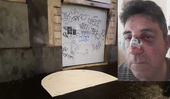 Catania, pannello si stacca da negozio e piomba addosso ad un passante