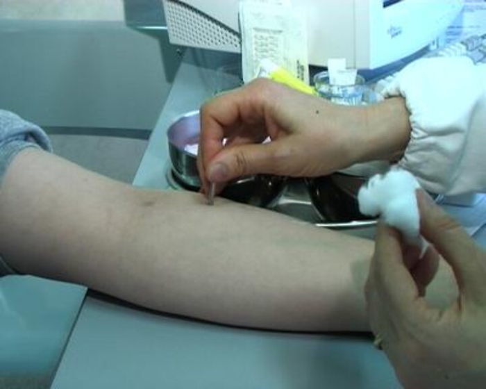 Alimenti: mappa delle allergie, quella alla pesca &egrave; la pi&ugrave; diffusa al Sud