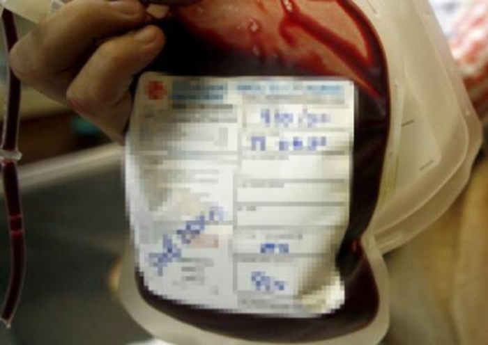 Palermo, esaurite le scorte di sangue: l’allarme dei medici e Ail