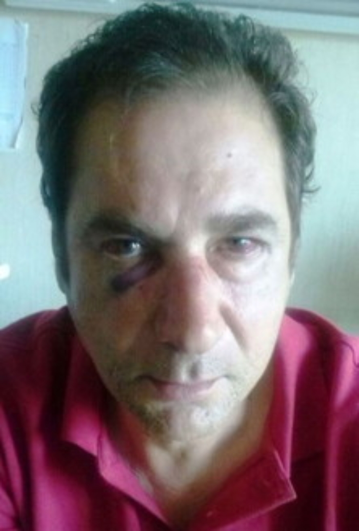 Gela: ragazzo lasciato da fidanzata chiede di essere arrestato e, al rifiuto, aggredisce carabiniere