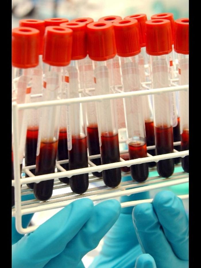 Mondiali: Fifa, nessun caso doping