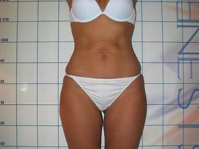 Salute: fisico a pera batte quello a mela, meno rischi per il cuore