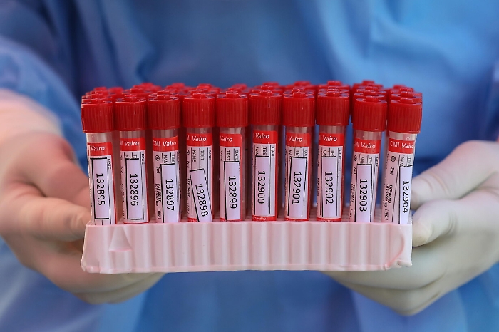 112138662-5e5c36a8-081a-4bc8-9efc-6ab906ce9383