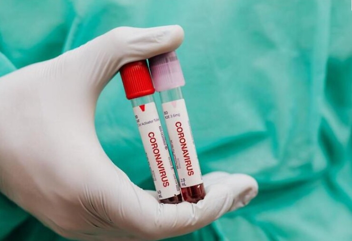 145923330-e5bb35fe-203b-4131-9b1b-b19ed029dfc4