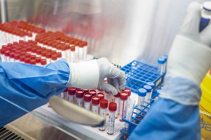 115836561-1b1f671d-b5a5-43c5-98fb-6e8626819310