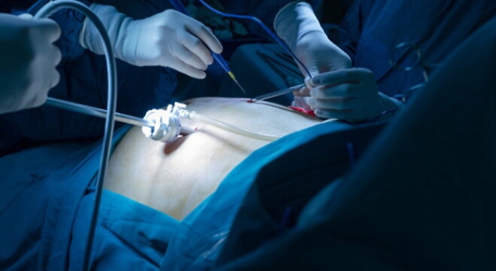 090336786-923afa09-9080-40c7-bb2b-1de3ea5aa829