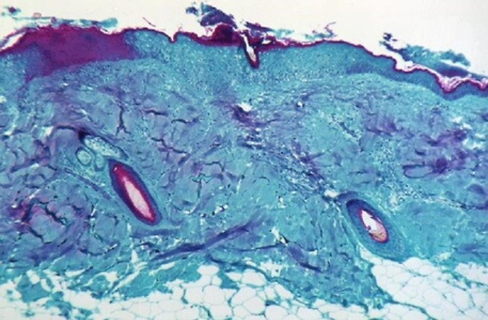 092227371-d8e931cd-289a-4f21-868b-c4e1dc4efe8e