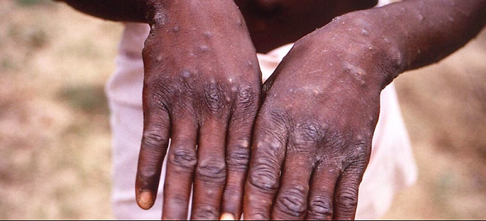 091219860-bb99e9dc-9fa0-4094-a803-2098c1d943d7