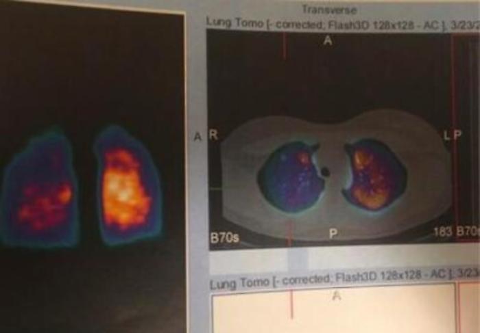 ADN20230123163755_1674488971589