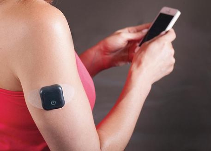 Diabete: impianto sottocutaneo per controllo glicemia