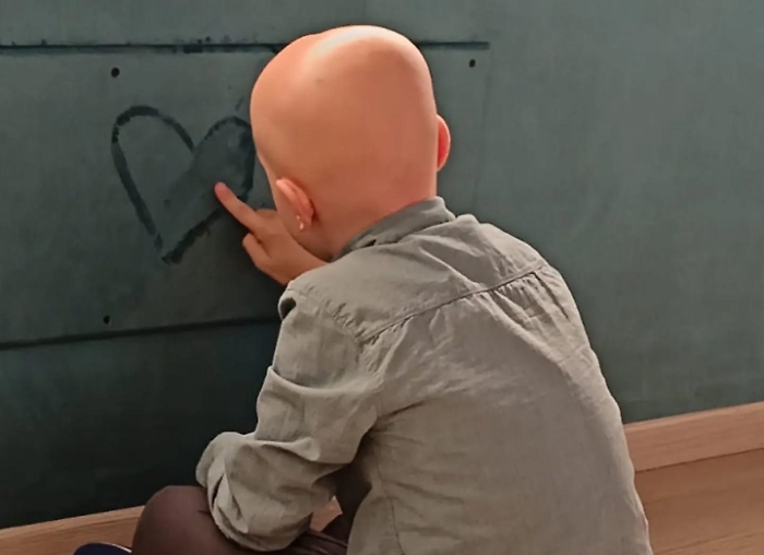 Sesta edizione dell&rsquo;&ldquo;Alopecia Areata Day&rdquo;