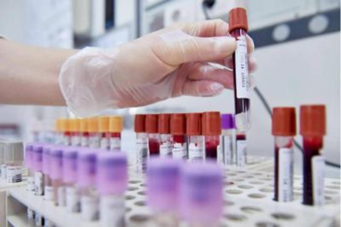 1733306721_d8c5e386b7b07956d794