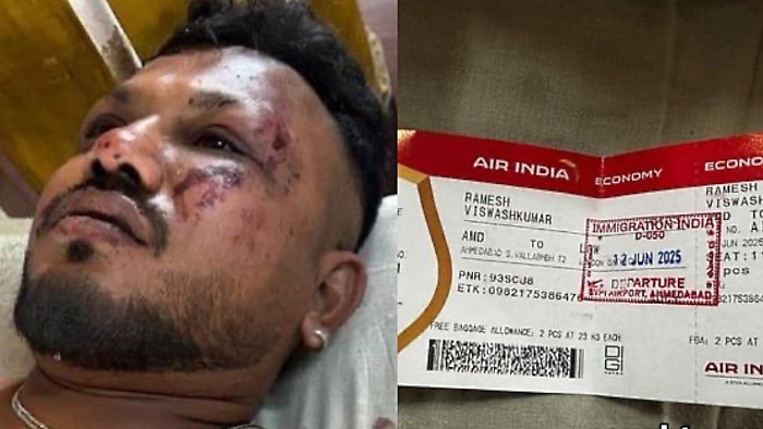 Il miracolo di Vishwash Kumar Ramesh, unico superstite della sciagura aerea in India