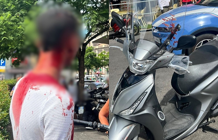 aggressione via gambino catania