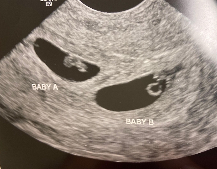 Vietato dalla legge, ma finanziato dai miliardari: la Silicon Valley punta su embrioni "corretti" per prevenire malattie e inseguire QI pi&ugrave; alto