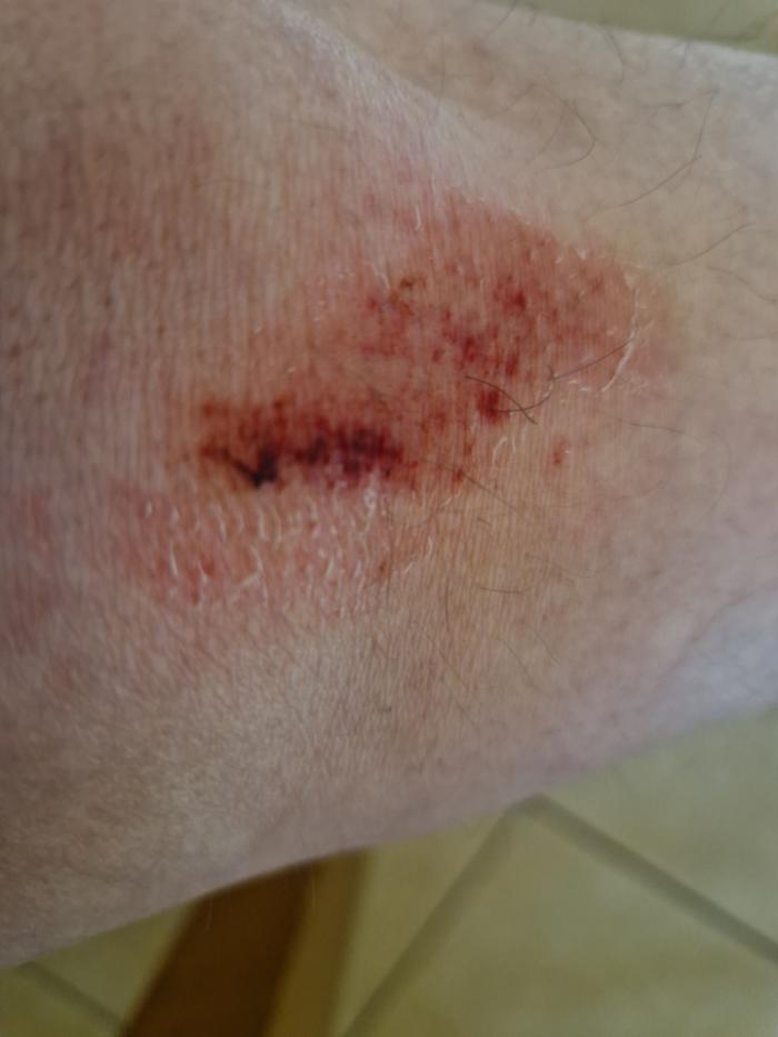 Vittoria: inciampa per una buca della strada, si fa male e scrive al sindaco: "Impossibile andare avanti cos&igrave;"