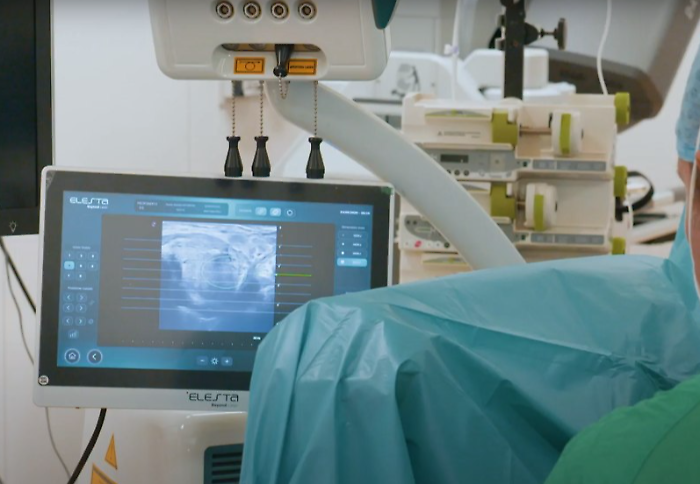 Trapianto d'urgenza a Napoli: bimbo di 2 anni operato con un cuore danneggiato, si indaga sull'uso di ghiaccio secco