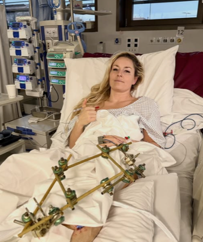 Lutto per la sciatrice Lindsey Vonn proprio il giorno dopo la rovinosa caduta