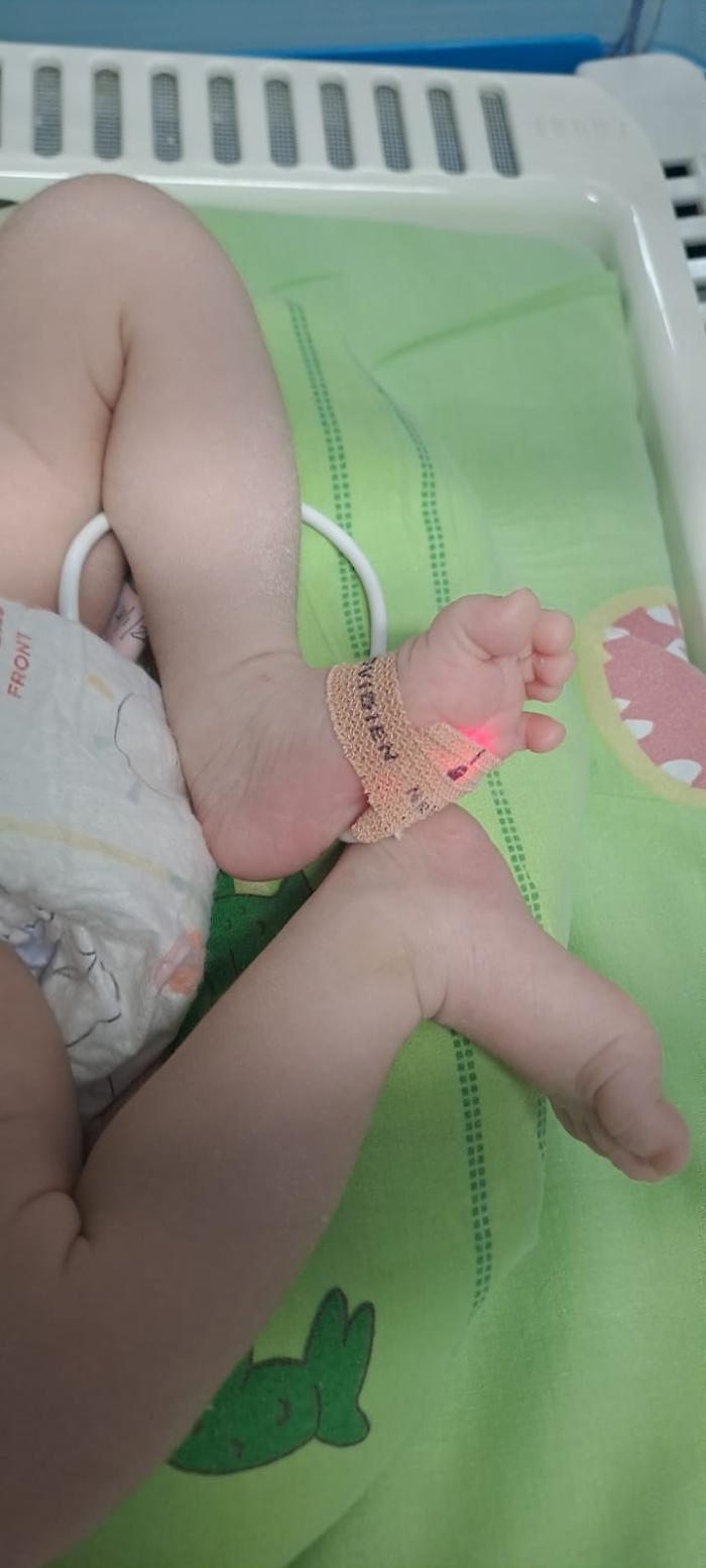 Piccolo guerriero torna a casa: il bimbo prematuro operato al cuore al Policlinico di Messina