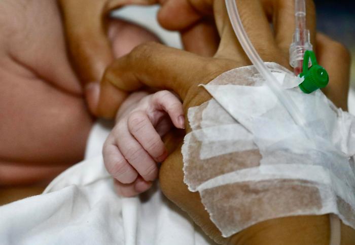 Nascita eccezionale a Palermo: il primo bambino portatore di glicogenosi 1A e 1B