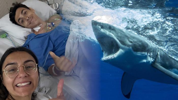 Luna di miele alle Maldive, squalo gli azzanna la gamba: il medico spagnolo sopravvive e ironizza sui social